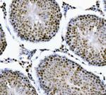 MBNL1 Antibody in Immunohistochemistry (Paraffin) (IHC (P))