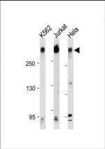 PCM1 Antibody in Western Blot (WB)