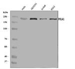 POLA1 Antibody in Western Blot (WB)