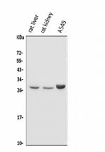 DIO1 Antibody in Western Blot (WB)