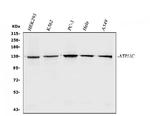 ATP11C Antibody in Western Blot (WB)