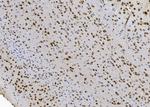 Nova-2 Antibody in Immunohistochemistry (Paraffin) (IHC (P))