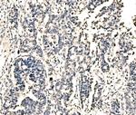 KIAA1429 Antibody in Immunohistochemistry (Paraffin) (IHC (P))