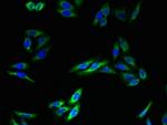 TMEM140 Antibody in Immunocytochemistry (ICC/IF)