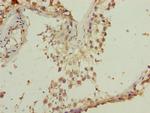 TMEM140 Antibody in Immunohistochemistry (Paraffin) (IHC (P))