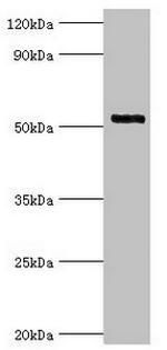 IRAK4 Antibody in Western Blot (WB)