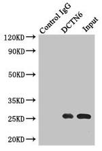 DCTN6 Antibody in Immunoprecipitation (IP)