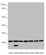 DCTN6 Antibody in Western Blot (WB)