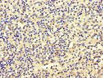 SBF2 Antibody in Immunohistochemistry (Paraffin) (IHC (P))