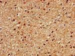 C1orf84 Antibody in Immunohistochemistry (Paraffin) (IHC (P))