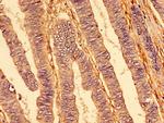 DR4 Antibody in Immunohistochemistry (Paraffin) (IHC (P))