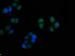 S100A7 Antibody in Immunocytochemistry (ICC/IF)