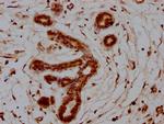 S100A7 Antibody in Immunohistochemistry (Paraffin) (IHC (P))