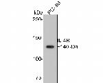 IL4R Antibody in Western Blot (WB)