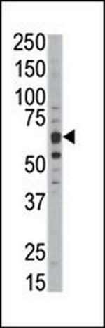 DYRK1B Antibody in Western Blot (WB)