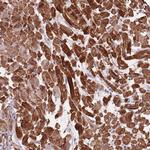 PPP1R14C Antibody in Immunohistochemistry (Paraffin) (IHC (P))