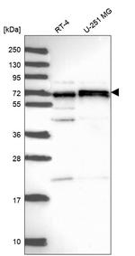 CDK5RAP1 Antibody in Western Blot (WB)