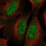 HSPB9 Antibody in Immunocytochemistry (ICC/IF)