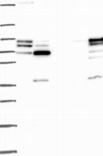 GRK2 Antibody in Western Blot (WB)