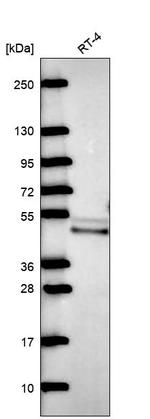 QTRTD1 Antibody in Western Blot (WB)
