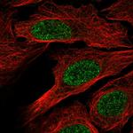 RXRB Antibody in Immunocytochemistry (ICC/IF)