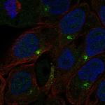 C1orf146 Antibody in Immunocytochemistry (ICC/IF)