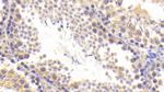 BACE2 Antibody in Immunohistochemistry (Paraffin) (IHC (P))
