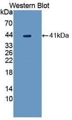 UGGT1 Antibody in Western Blot (WB)
