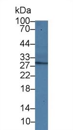 Adiponectin Antibody in Western Blot (WB)