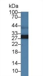 Adiponectin Antibody in Western Blot (WB)