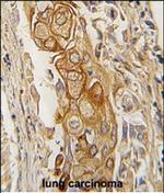 Prostate Specific Acid Phosphatase Antibody in Immunohistochemistry (Paraffin) (IHC (P))