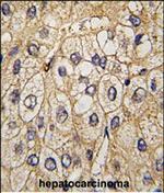 EphA7 Antibody in Immunohistochemistry (Paraffin) (IHC (P))