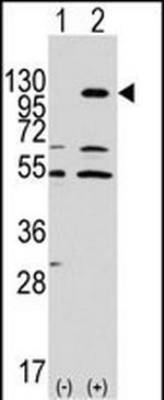 EphA7 Antibody in Western Blot (WB)