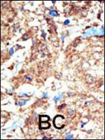 EphB1 Antibody in Immunohistochemistry (Paraffin) (IHC (P))