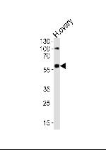 RYK Antibody in Western Blot (WB)