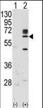 RYK Antibody in Western Blot (WB)