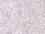 TPRX1 Antibody in Immunohistochemistry (Paraffin) (IHC (P))