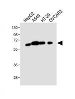 CYP3A4 Antibody in Western Blot (WB)