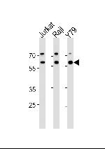 Acetylcholinesterase Antibody in Western Blot (WB)
