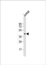 PIM1 Antibody in Western Blot (WB)