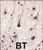 PIK3R2 Antibody in Immunohistochemistry (Paraffin) (IHC (P))