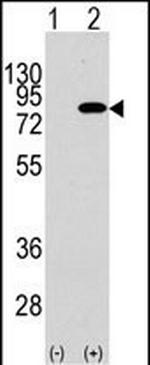 PIK3R2 Antibody in Western Blot (WB)