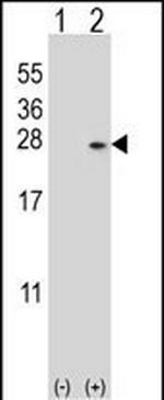 DUSP14 Antibody in Western Blot (WB)