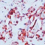 VEGF Receptor 1 Antibody in Immunohistochemistry (Paraffin) (IHC (P))