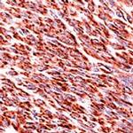 Desmin Antibody in Immunohistochemistry (Paraffin) (IHC (P))