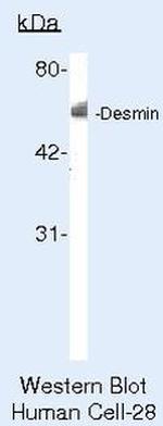 Desmin Antibody in Western Blot (WB)