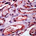 NFkB p65 Antibody in Immunohistochemistry (IHC)