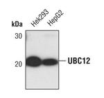 UBE2M Antibody in Western Blot (WB)