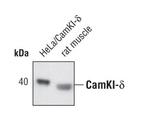 CAMK1D Antibody in Western Blot (WB)