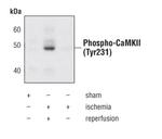 Phospho-CaMKII alpha/beta/delta (Tyr231) Antibody in Western Blot (WB)